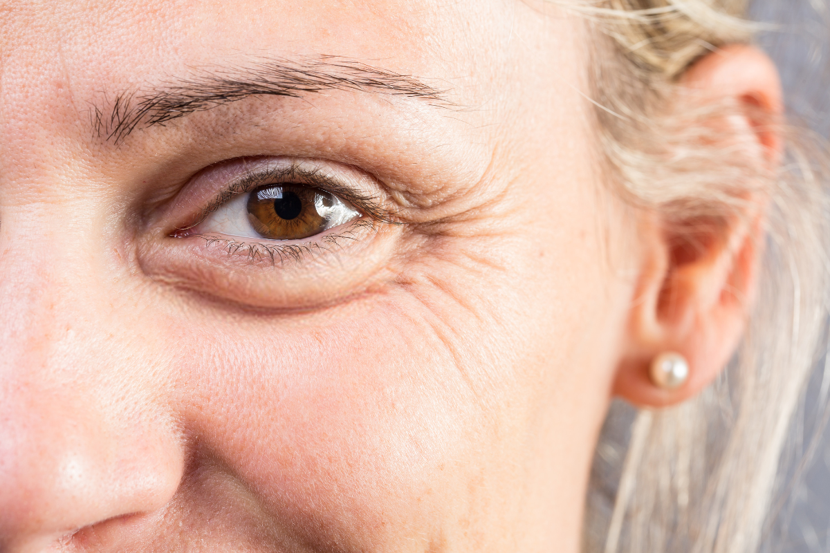 Kollagen - rynkor och linjer collagen wrinkles fine lines celloptimum