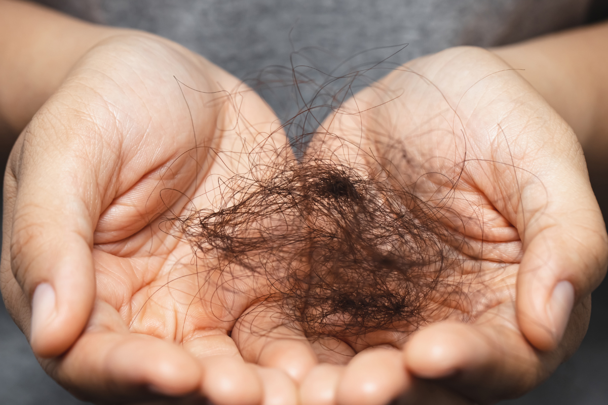 Håravfall och klimakteriet hair loss post menopause celloptimum