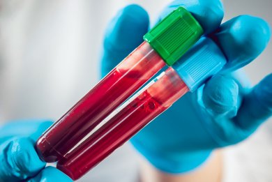 Blood test - only available in Sweden